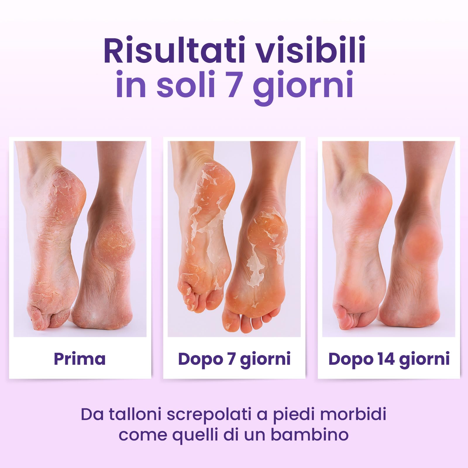 Maschera Piedi Esfoliante (6 Paia), Trattamento per Talloni Screpolati con Lavanda e Burro di Karité, Peeling Piedi Idratante per Uomo e Donna, Calzini Esfolianti Taglia Unica