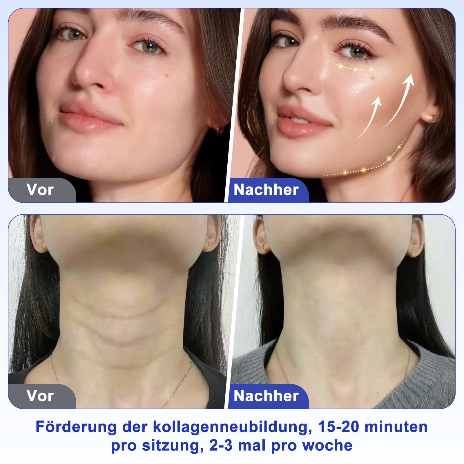 40K Massagegerät, 4-in-1 Ultraschall- und Radiofrequenzgerät, Schönheitsgerät für Gesicht und Körper zur täglichen Hautpflege