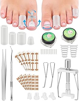 Ingrown Toenail Removal Kit, Ingrown Toenail Treatment, Ingrown Toenail Corrector Tools Come with Podiatry Toenail Braces, Ingrown Toenail Corrector Strips and Patch for Toe Pain Relief