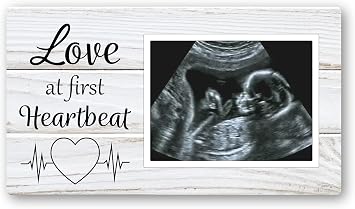 Love at First Heartbeat Ultrasound Picture Frames Fridge Magnet, Rustic Keepsake Sonogram Picture Frame, Nursery New Mom Gifts, Baby Shower Gifts, Newborn Essentials Must Haves, Protective Photo Frame