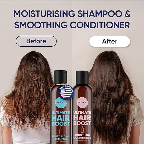 Miniatura 2 de Moerie Ultimate Hair Growth - Juego de champú y acondicionador para el crecimiento del cabello, cabello más largo, grueso, más completo, vegano,