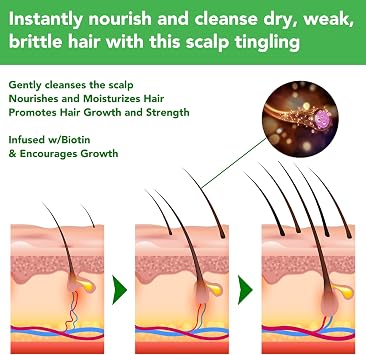 Rosemary Shampoo for Hair Growth, Rosemary Mint Strengthening Hair Growth Shampoo with Biotin, Repairing and Nourishing Scalp, Anti Hair Loss Shampooing for Women Men, Sulfate Free, 300ml