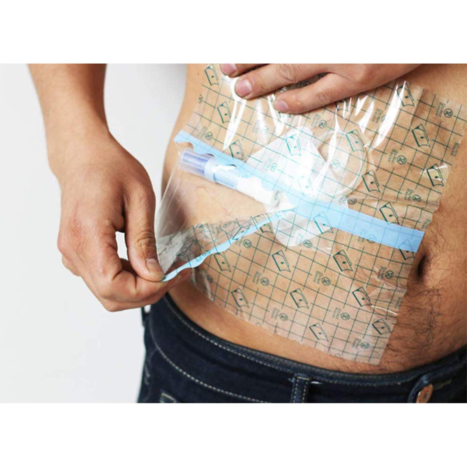 Buy Nlight Transparent Dressing Waterproof Wound Seal 50 Pack Clear