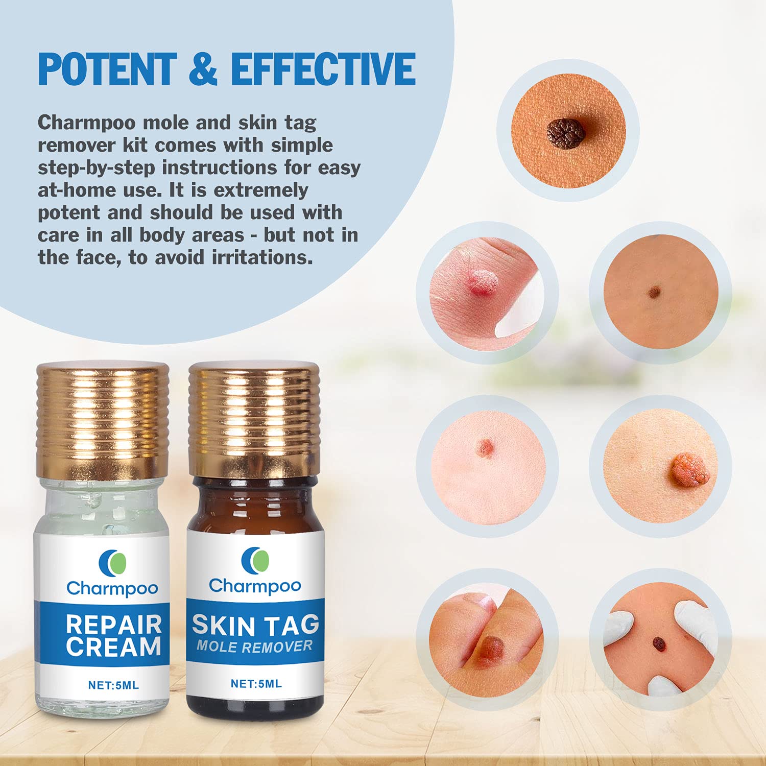 Charmpoo Skin Tag Removal All Natural Mole and Skin Tag Remover and