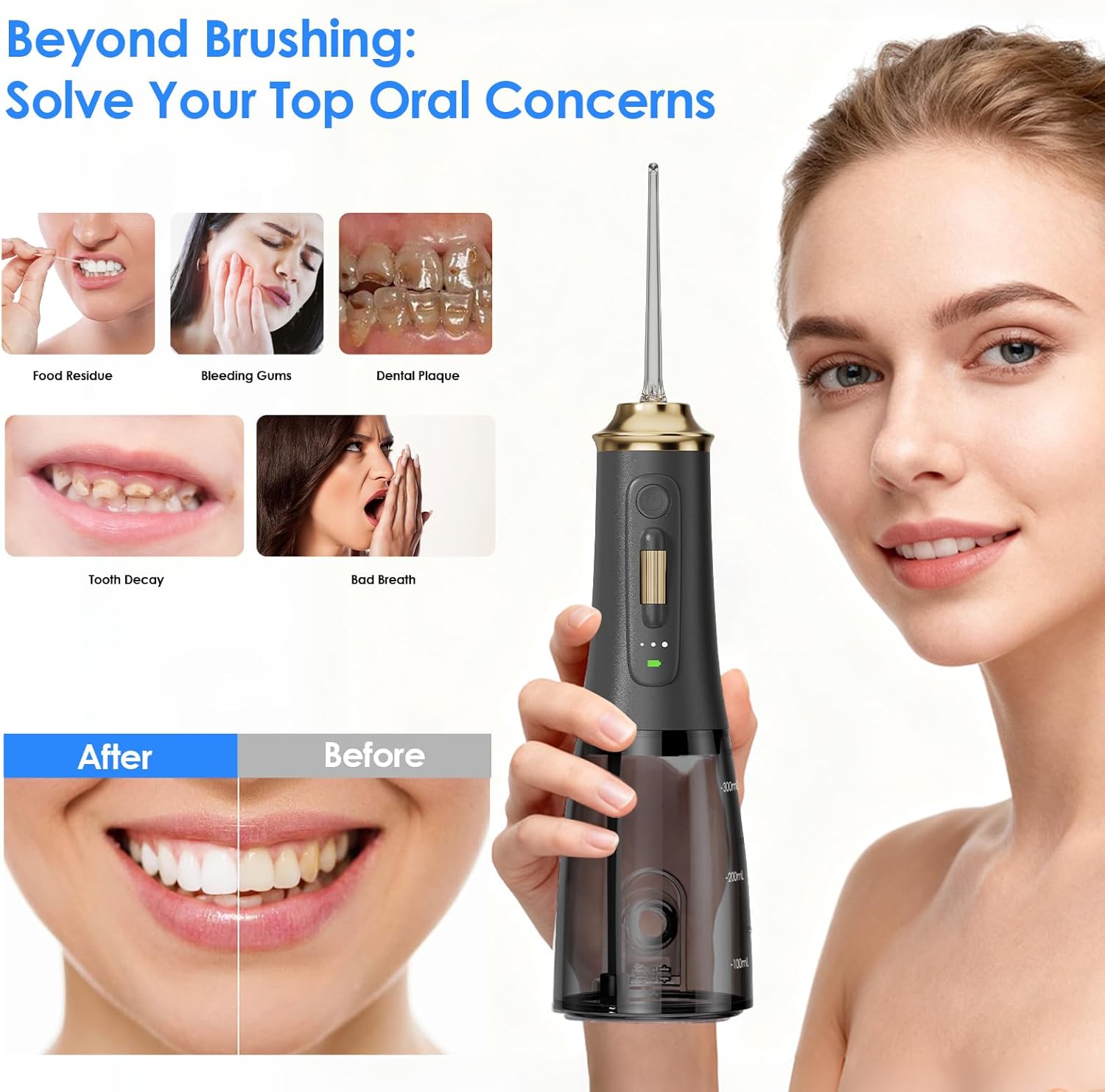 300ML Long-Lasting Battery Life Water Flosser Adjustable Pressure Oral Irrigator Flosser with 4 Interchangeable Nozzle Tips for Implants/Braces/Receding Gums (Black&Gold)
