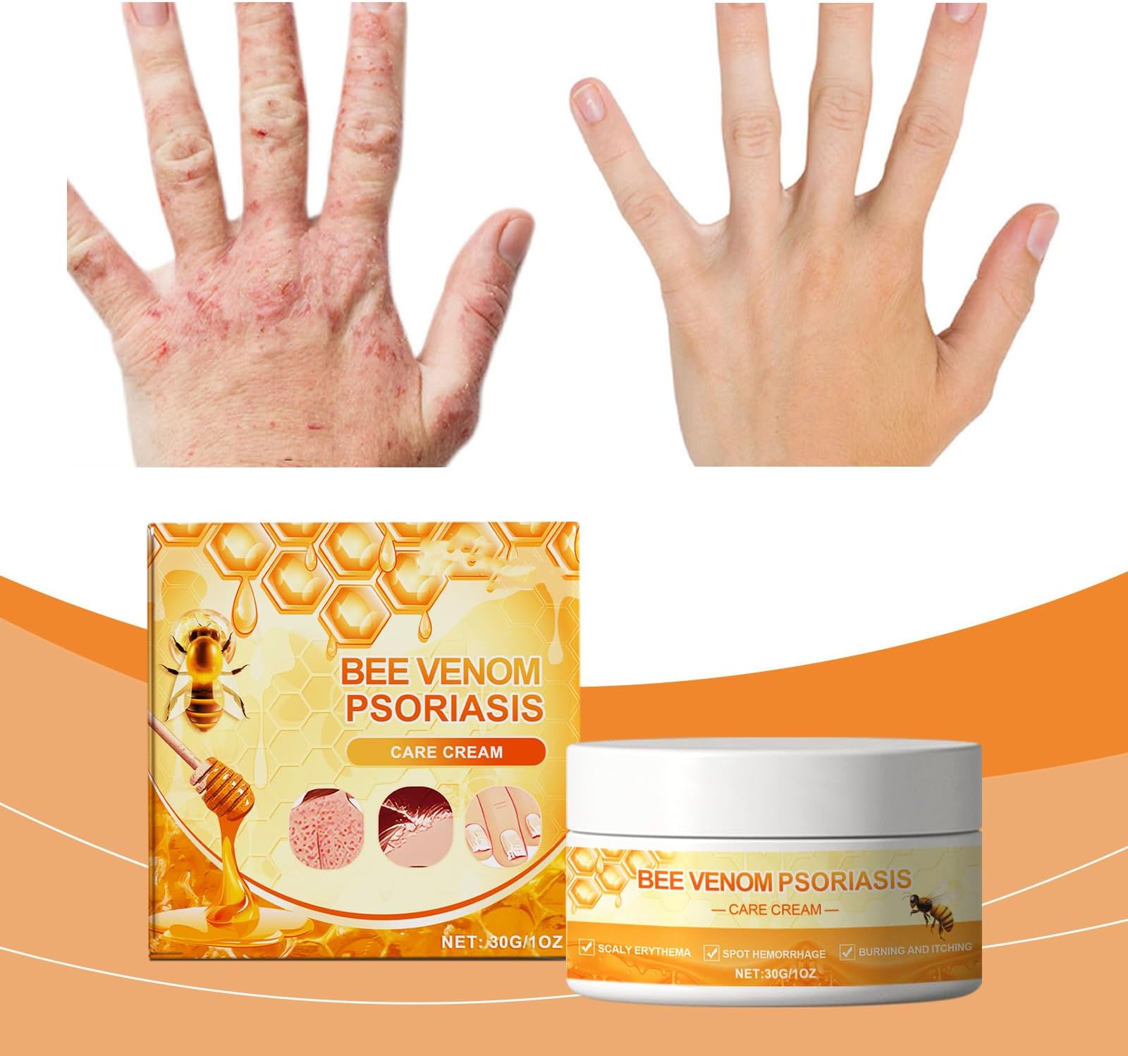 Azonee 30g Hand and Foot Repair Cream, Cracked Skin Repair Cream, Winter, Moisturizing and Hydrating Heel Crack Repair Cream, Dry Foot Mask, Dry Feet, Hands, Heel, Elbows, Nails,Crack Repair Cream