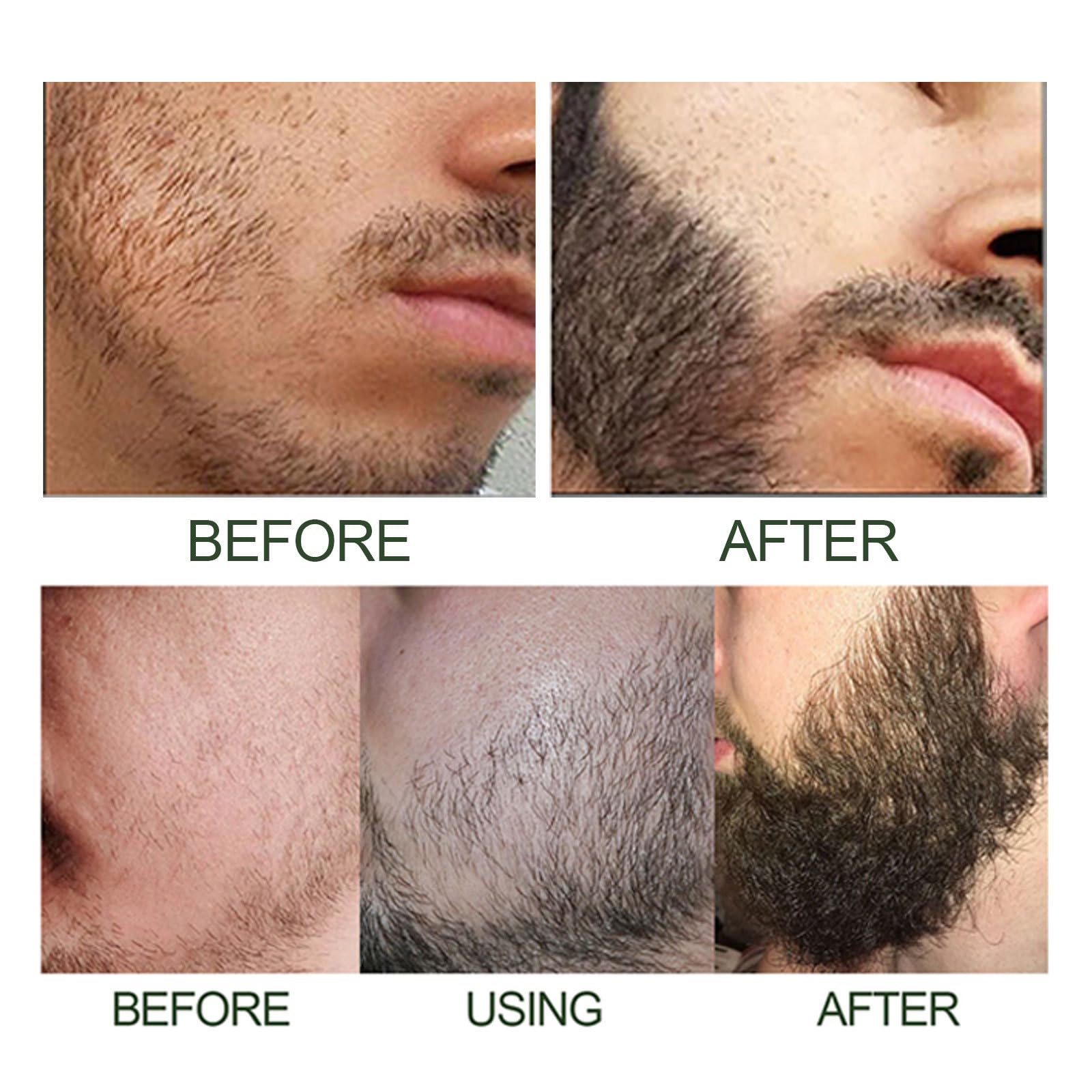 Cuidado para Barba Esencia Roller Set, Jimkply Cuidado Profundo para Barba Suave y Seda, Reduce Efectivamente el Encrespamiento y la Sequedad, Mejora Visiblemente la Textura y el Brillho de la Barba