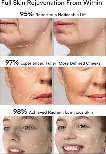 Miniatura 4 de INIA Terapia de luz roja 3 en 1 para cara y cuello dispositivo de belleza para hinchazón y reafirmación de la piel herramienta de cuidado de la piel