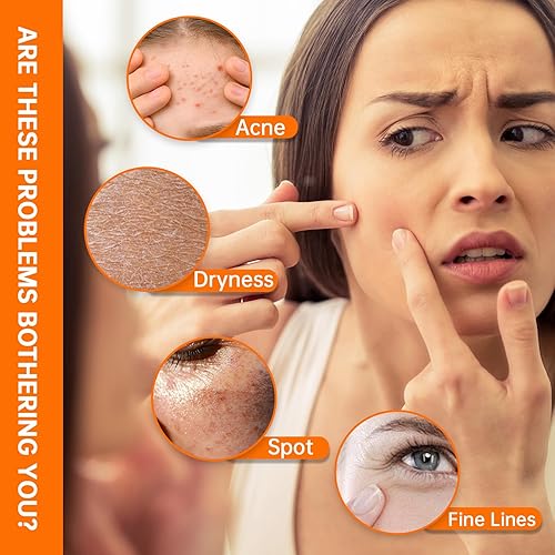 Miniatura 5 de Suero de niacinamida 10% + 1% de zinc, suero de niacinamida antienvejecimiento para cara, 1 suero facial hidratante para todo tipo de piel, cuidado