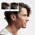 Nioxin System 2 Scalp + Hair Thickening Shampoo | For Natural with Progressed Thinning | Cleanse & Boost Density with Niacinamide & Biotin