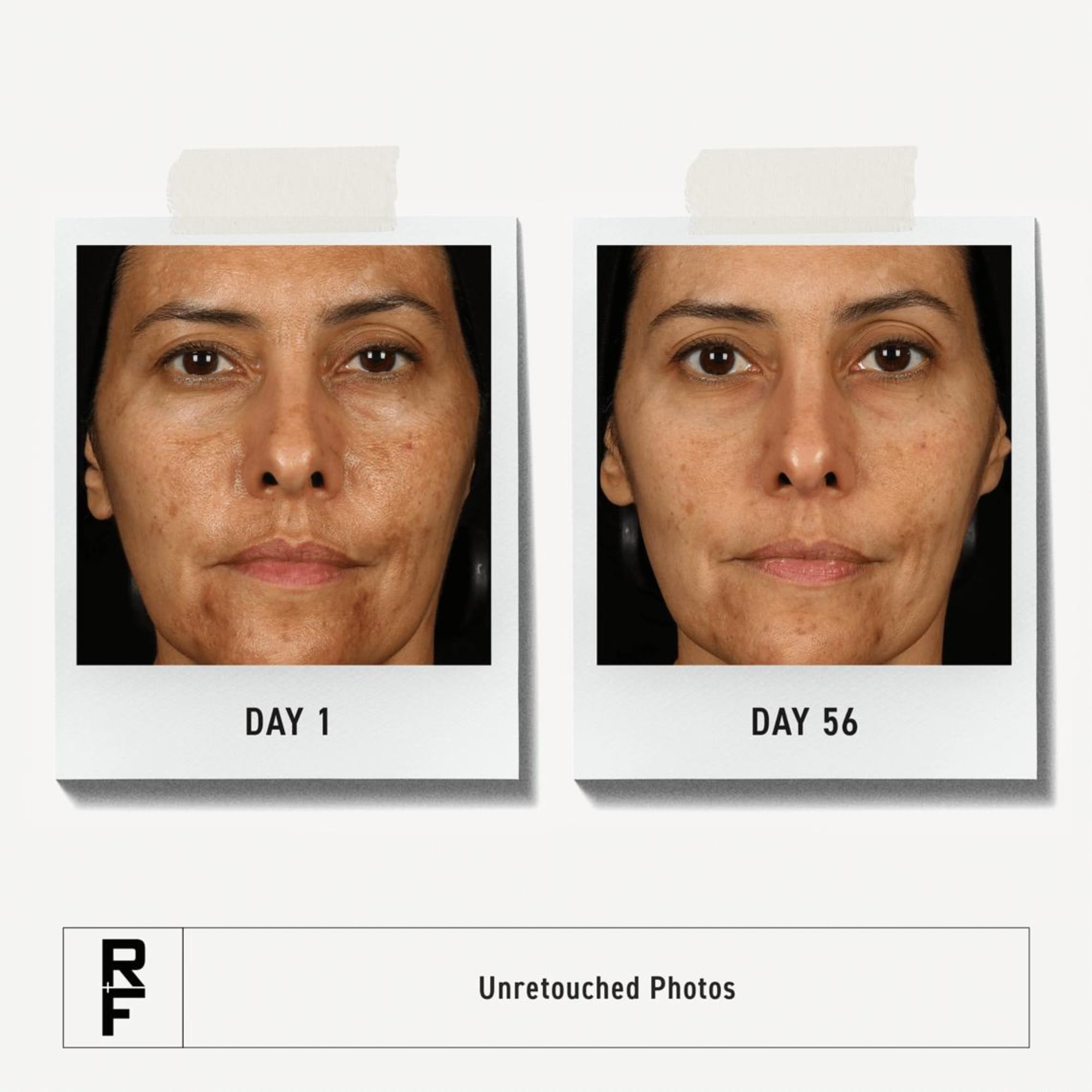 Amazon.com: Rodan + Fields Multi-Acid Enzyme Peel | 30 ml