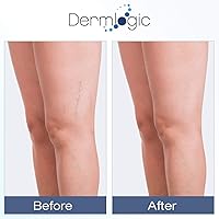 Vista 3 de Vitamin K Cream- Moisturizing Bruise Healing Formula. Dark Spot Corrector for Bruising, Spider Veins & Broken Capillaries. Reduces Under Eye Dark