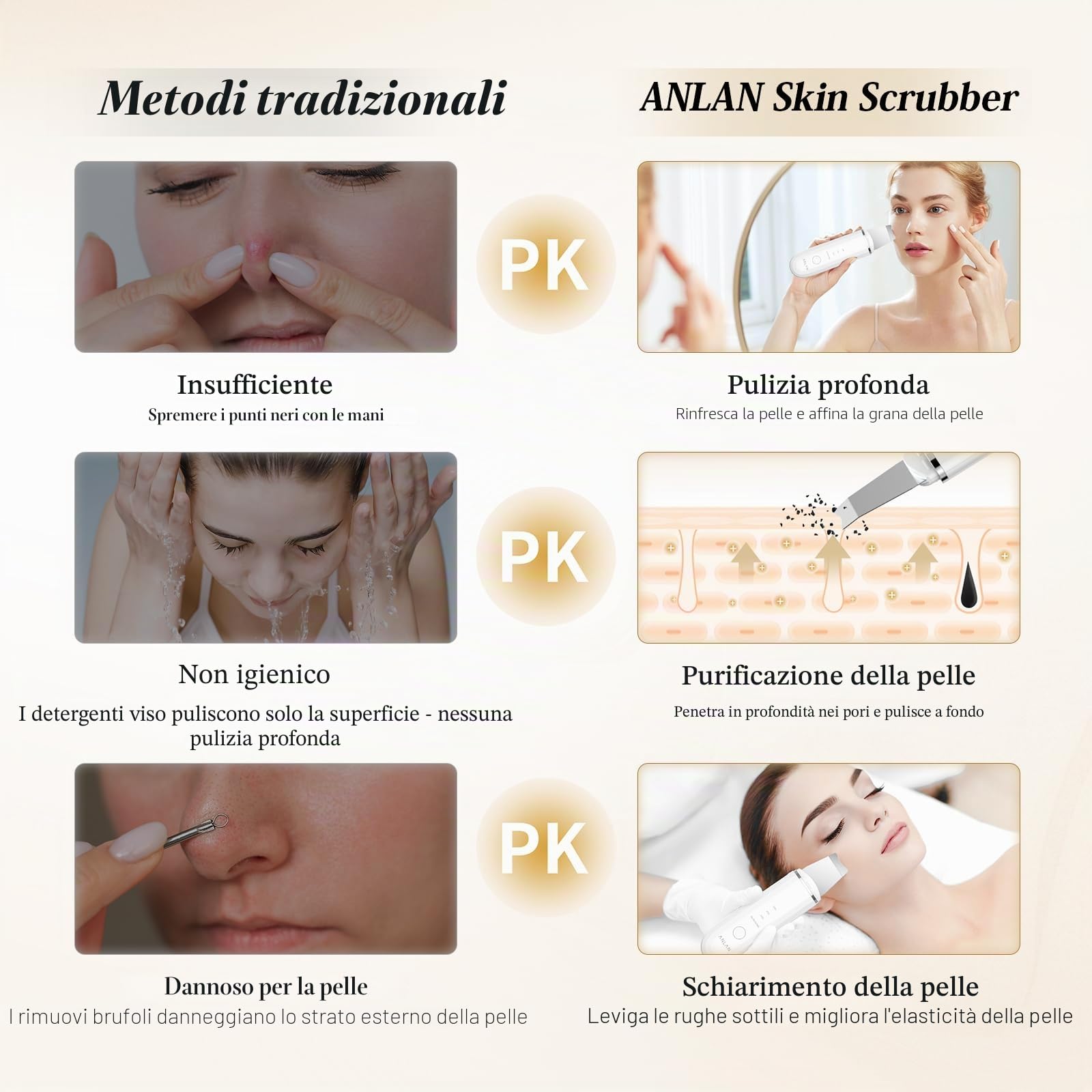 Pulizia Viso Ultrasuoni, ANLAN Skin Scrubber Professionale Per Pulizia Profonda la Viso Peeling e Cura,4 Modalità Rimozione di Comedone Punti Neri Rimozione, USB Ricaricabile