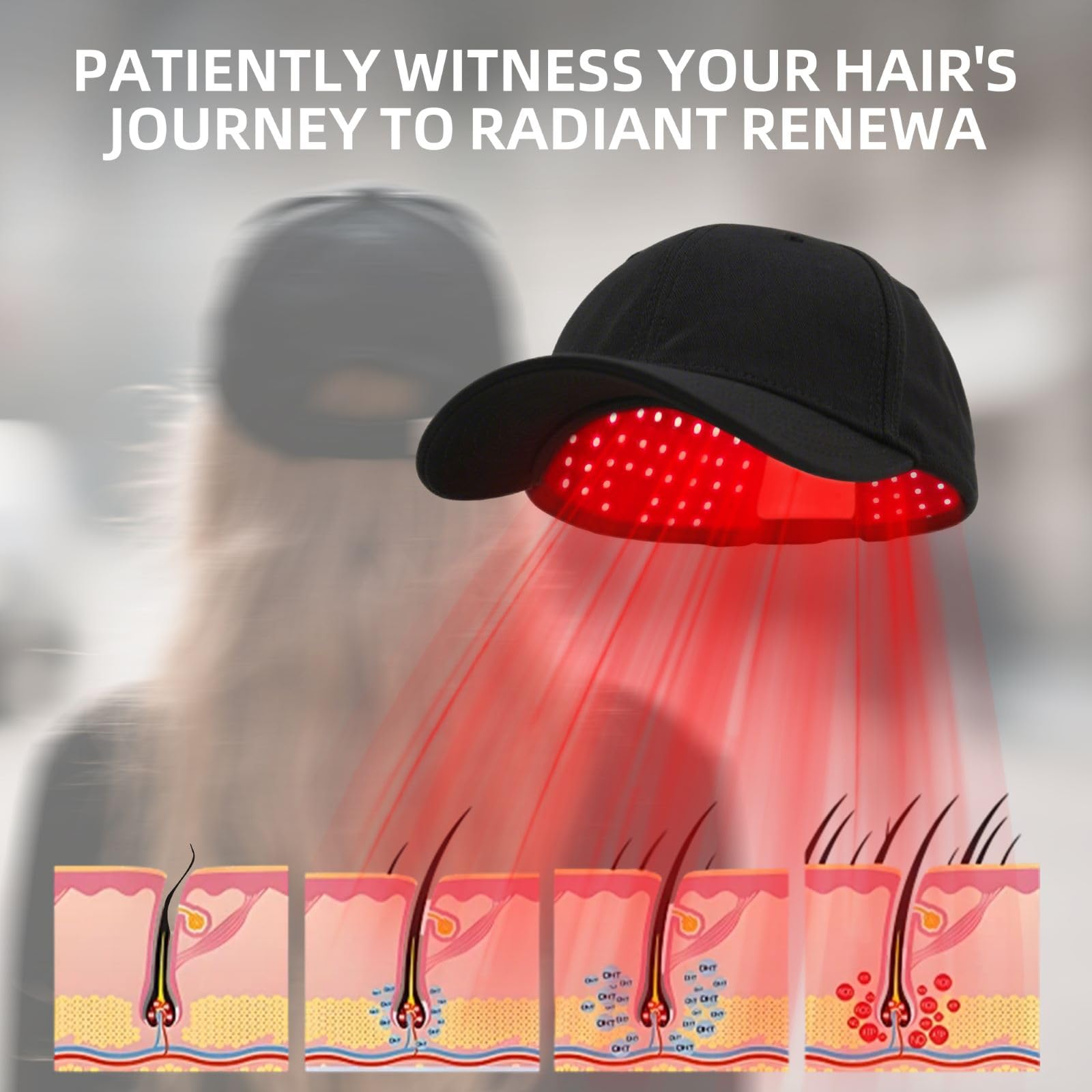 Amazon.com: 2026 Upgrade Wireless Laser Cap for Hair Regrowth, Red
