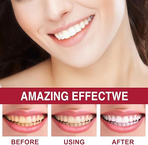 Miniatura 7 de SP-6 Probióticos pasta de dientes blanqueadora, con probióticos limpieza profunda cuidado bucal que elimina las manchas de los dientes y retiene el