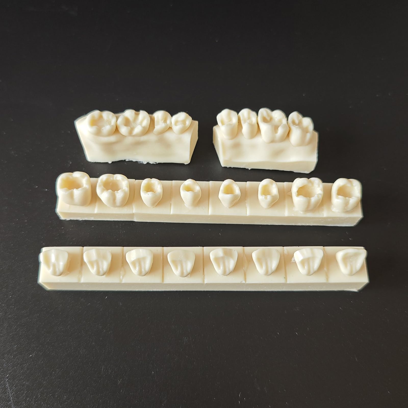 Modello di Pratica per otturazioni dentali in Resina 4 Pezzi Modello di cavità di Classe II Typodont per Studio e insegnamento