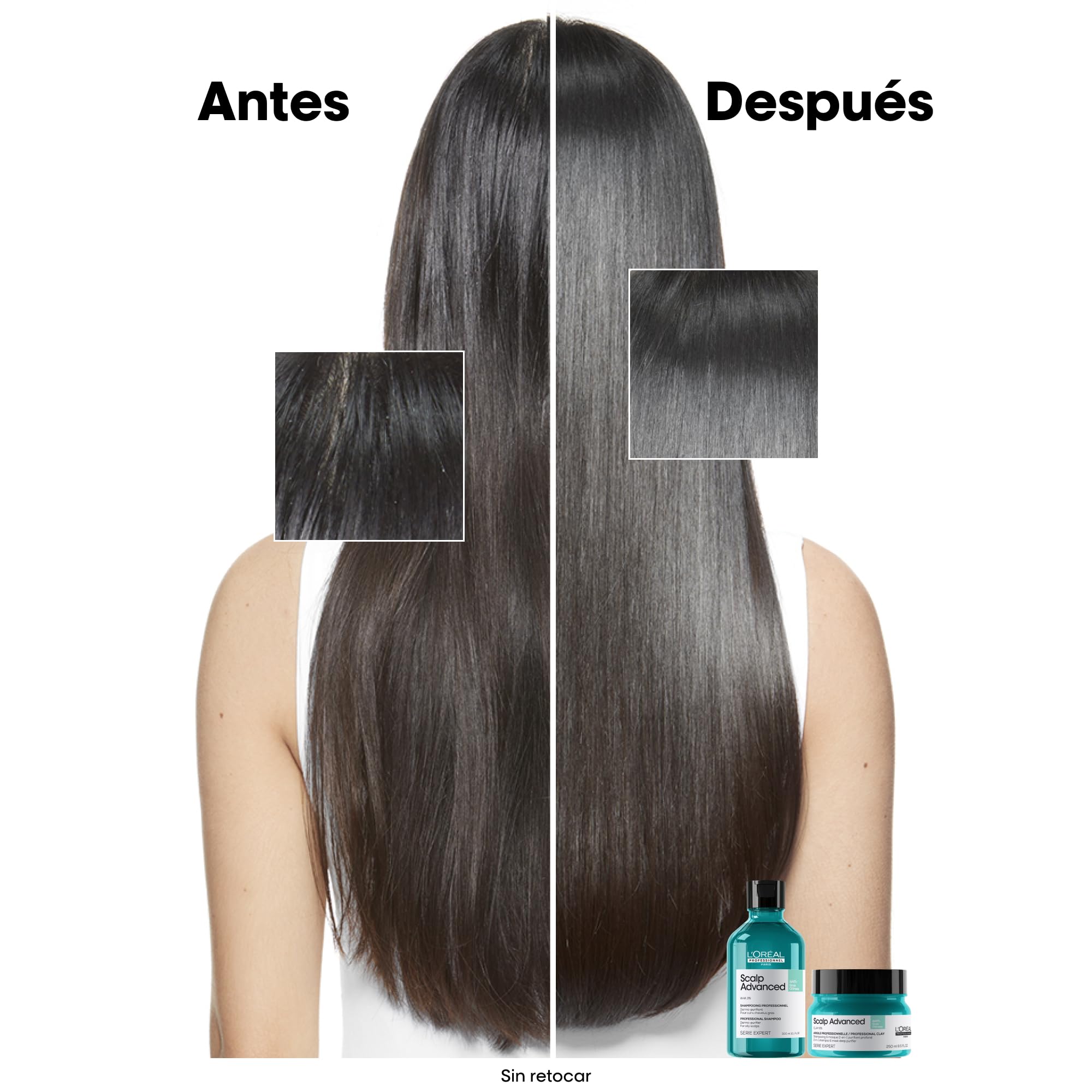 L’Oréal Professionnel, Champú Pelo Graso y Arcilla, con Activos Dermatológicos, Champú Antigrasa, Diseñador para Pelo Graso y Fino, Scalp Advanced, 250 ml