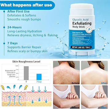 Glycolic Acid stick, Exfoliating Body Stick with 7% AHA 0.5% BHA & Shea Butter, Solid Non-Messy Texture, Smooths Rough Skin for Body, Arms, Legs, Underarms 75g