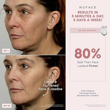 NuFACE MINI Classic Microcurrent Facial Device Kit - Face Sculpting Tool & Neck Tightening Device to Contour & Smooth + Activating Aqua Conductive Gel for Microcurrent Treatment