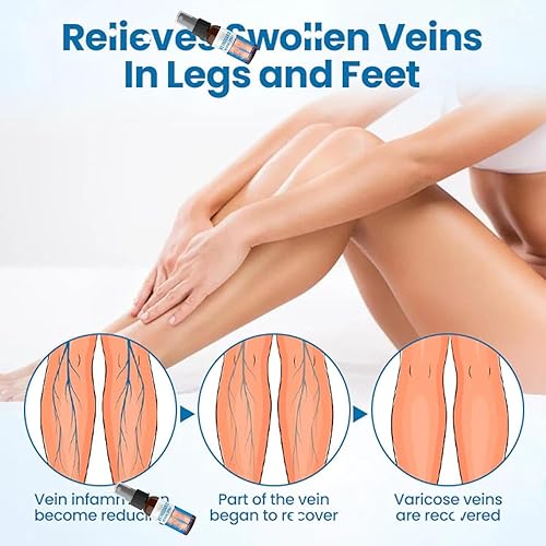 Miniatura 4 de VeinGuard - Aerosol de hierbas profesional, para venas varicosas para piernas, spray de hierbas protector de venas, adecuado para todo tipo de piel,