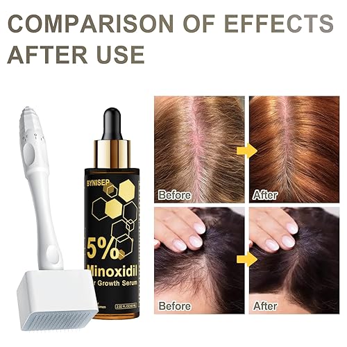 Miniatura 5 de Suero para el crecimiento del cabello de minoxidil al 5% para hombres y mujeres, para el tratamiento del crecimiento del cabello y la barba - 2.0 fl