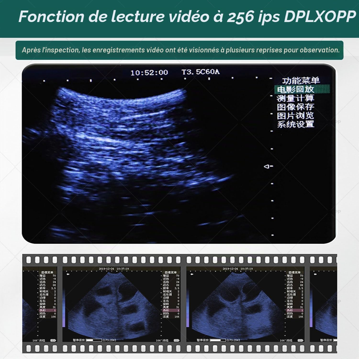 échographe Vétérinaire Portable,Appareil échographie avec Sondes (M1, M2, M3) pour Diagnostic De Gestation des Porcs,Bovins,Ovins,Chevaux,Chiens & Chats,écran LED 5.6" M3