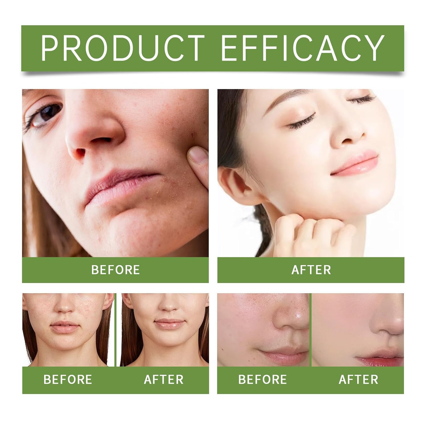 Aloe Vera Exfoliating Gel,Facial Exfoliator Cleanser for Face & Body,Exfoliating Gel Scrub with Aloe Vera Herbal Extract Cleanses the Skin,Hydrate and Moisturize,Suitable for All Skin Types,3.53 Fl Oz - Image 7