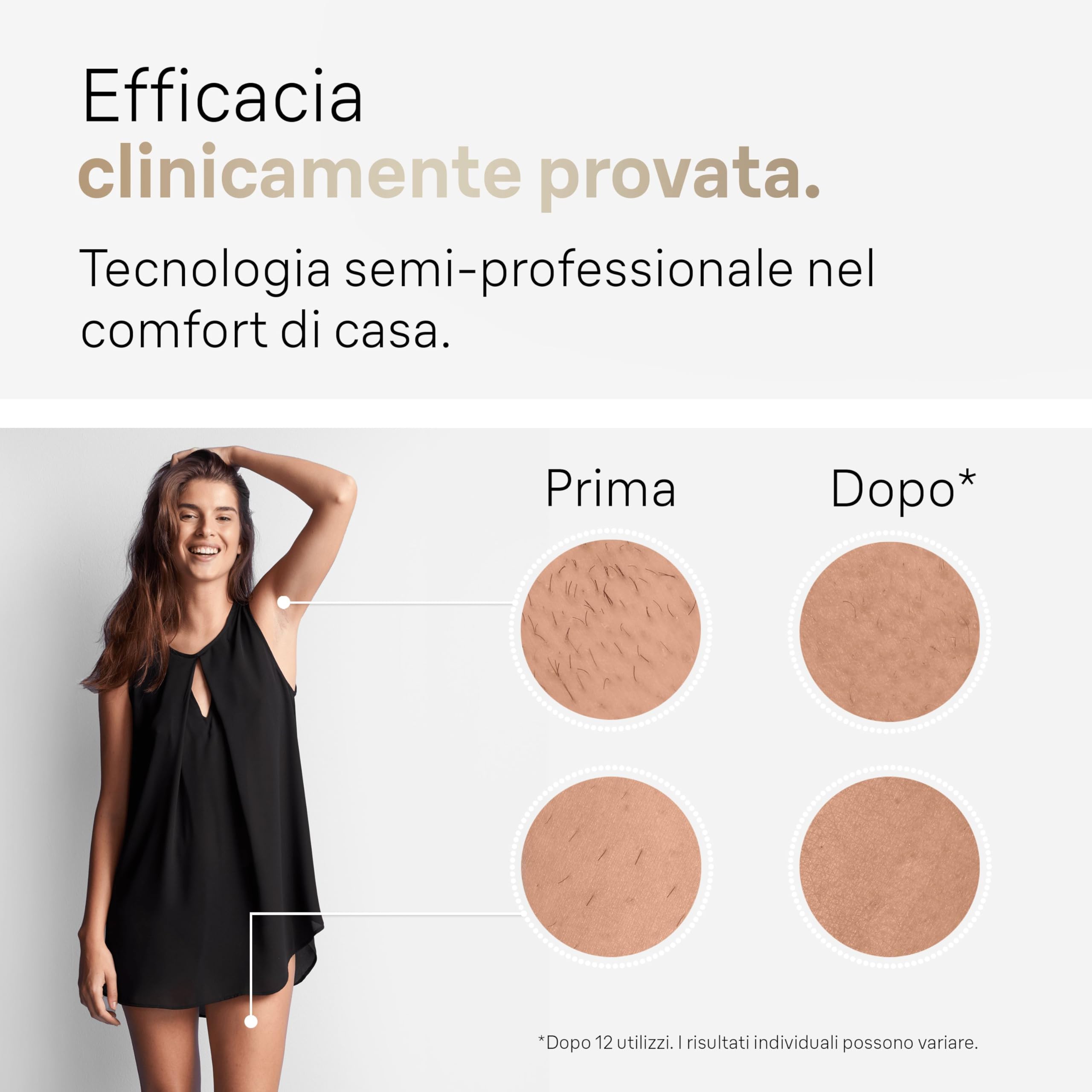 Braun Silk·expert Pro 5 Epilatore LUCE PULSATA, Epilazione A Casa, Alternativa All’Epilazione laser, Con Custodia, Rasoio Donna Venus, 4 Testine, Idea Regalo, Bianco/Oro, PL5382