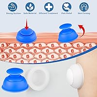 Vista 3 de Juegos de terapia de ventosas de silicona, 10 unidades, ventosas profesionales al vacío para masaje miofascial, dolor en las articulaciones, Blanco