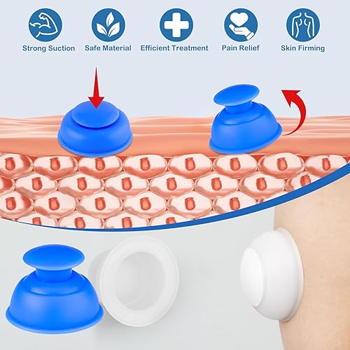 Miniatura 3 de Juegos de terapia de ventosas de silicona, 10 unidades, ventosas profesionales al vacío para masaje miofascial, dolor en las articulaciones,