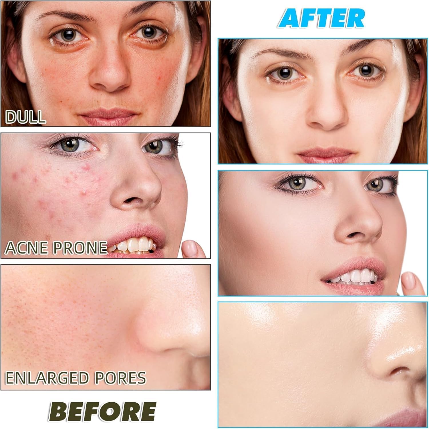 hemzex Kojic Acid Face Cleansing Pads for Dark Spots, Skin Brightening & Acne Prevention | Vitamin C, Retinol & Chamomile Hydrolat | For Women & Men | All Skin Type | 60 Pieces Pack of 1 3