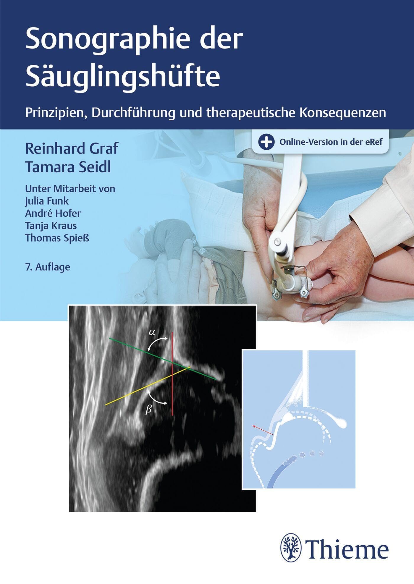 Sonographie der Säuglingshüfte: Prinzipien, Durchführung und therapeutische Konsequenzen