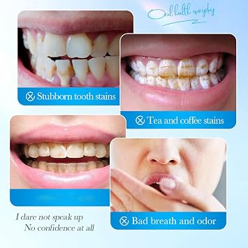 Probiotic Toothpaste, Natural Toothpaste for Sensitive Teeth, Travel-Friendly Mint Toothpaste for Teeth, Cleaning Stain Removal, Protects Gums, Promotes Good Condition Teeth (3)