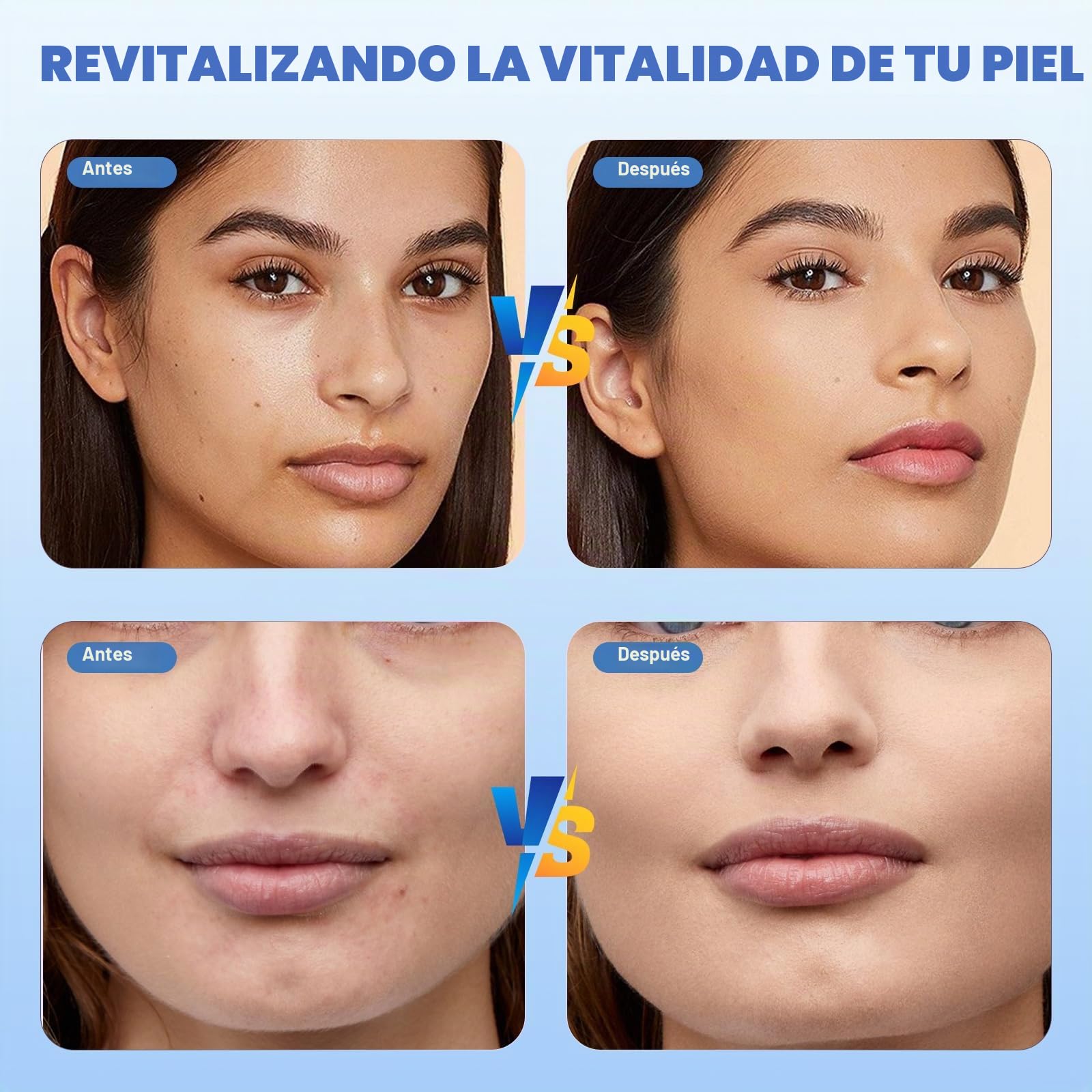 TopDirect Dermapen Profesional, Dr Pen A8S Microneedling, Derma Pen Eléctrico Auto Recargable para Facial y Cuerpo, 0-2,5 mm Ajustable con 6 Niveles de Velocidad, 6 unidades Agujas Dermapen