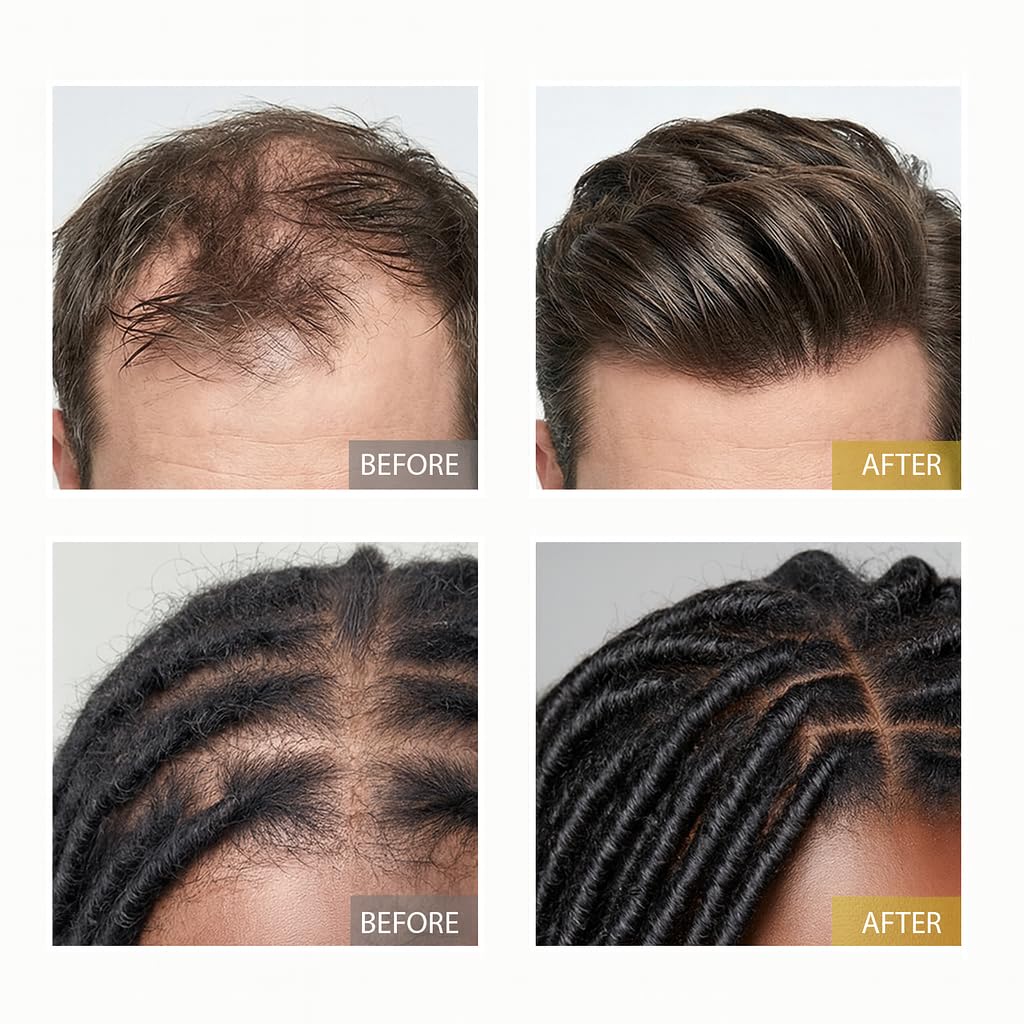 Herbal Hair Growth Oil – Extra Strength Natural Rosemary + Fenugreek Infused Blend with 10 Plant Oils for Stronger, Fuller-Looking Hair & Nourished Scalp | Vegan & Pure | 3.38 fl oz - Image 6