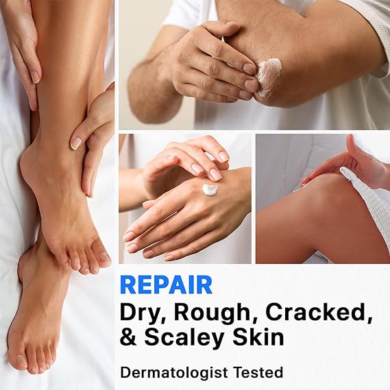 40% Urea Cream,Urea Foot & Hand Cream 40 Percent for Cracked Heels and Dry Skin,Cracked Heel Repair cream,Deep Moisturizing, Callus Remover and Soften, Foot Moisturiser for Women&Men,Maximum Strength