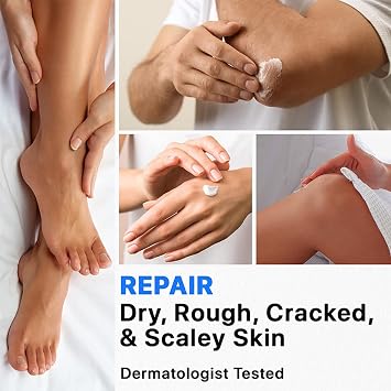40% Urea Cream,Urea Foot & Hand Cream 40 Percent for Cracked Heels and Dry Skin,Cracked Heel Repair cream,Deep Moisturizing, Callus Remover and Soften, Foot Moisturiser for Women&Men,Maximum Strength