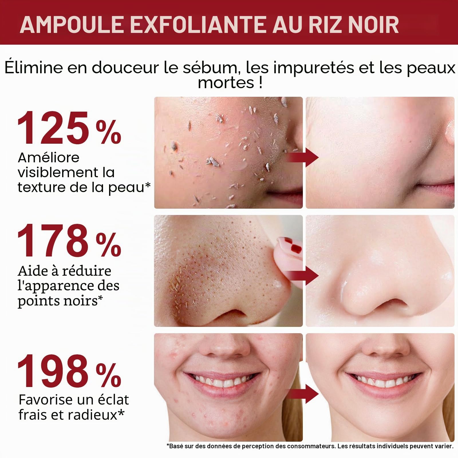 Sérum Exfoliant Visage au Riz Blanc 100ml + Riz Noir 100ml, Peeling Visage Doux AHA BHA VB3, Élimine Peaux Mortes, Affine le Grain de Peau, Réduit Pores, Éclat & Hydratation, Soin Coréen,Toute la Peau