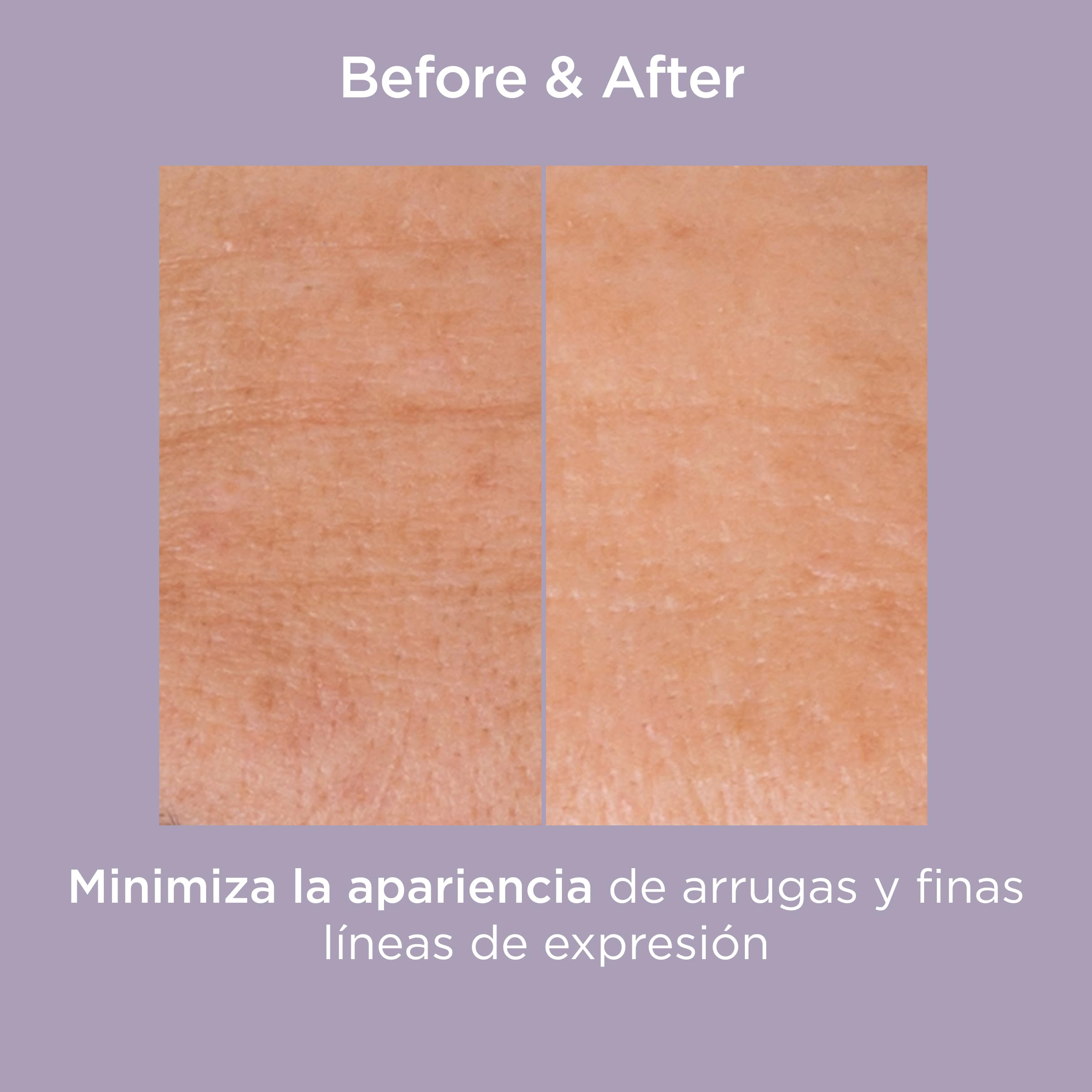ISDIN Isdinceutics Glicoisdin 25 Gel Exfoliante con Ácido Glicólico, Acción Exfoliante para Una Piel Renovada, 25 g