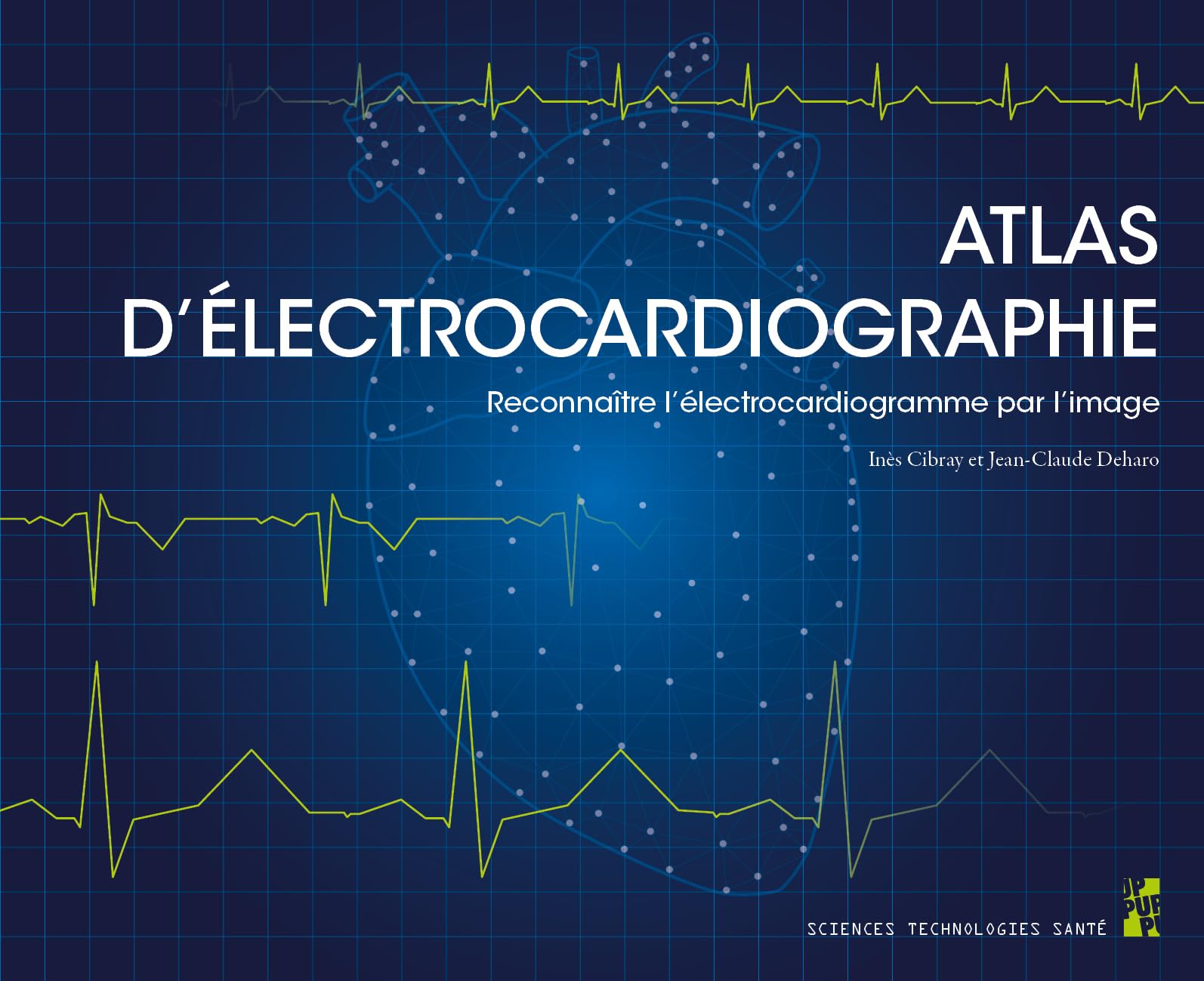 Atlas d’électrocardiographie: Reconnaître l’électrocardiogramme par l’image