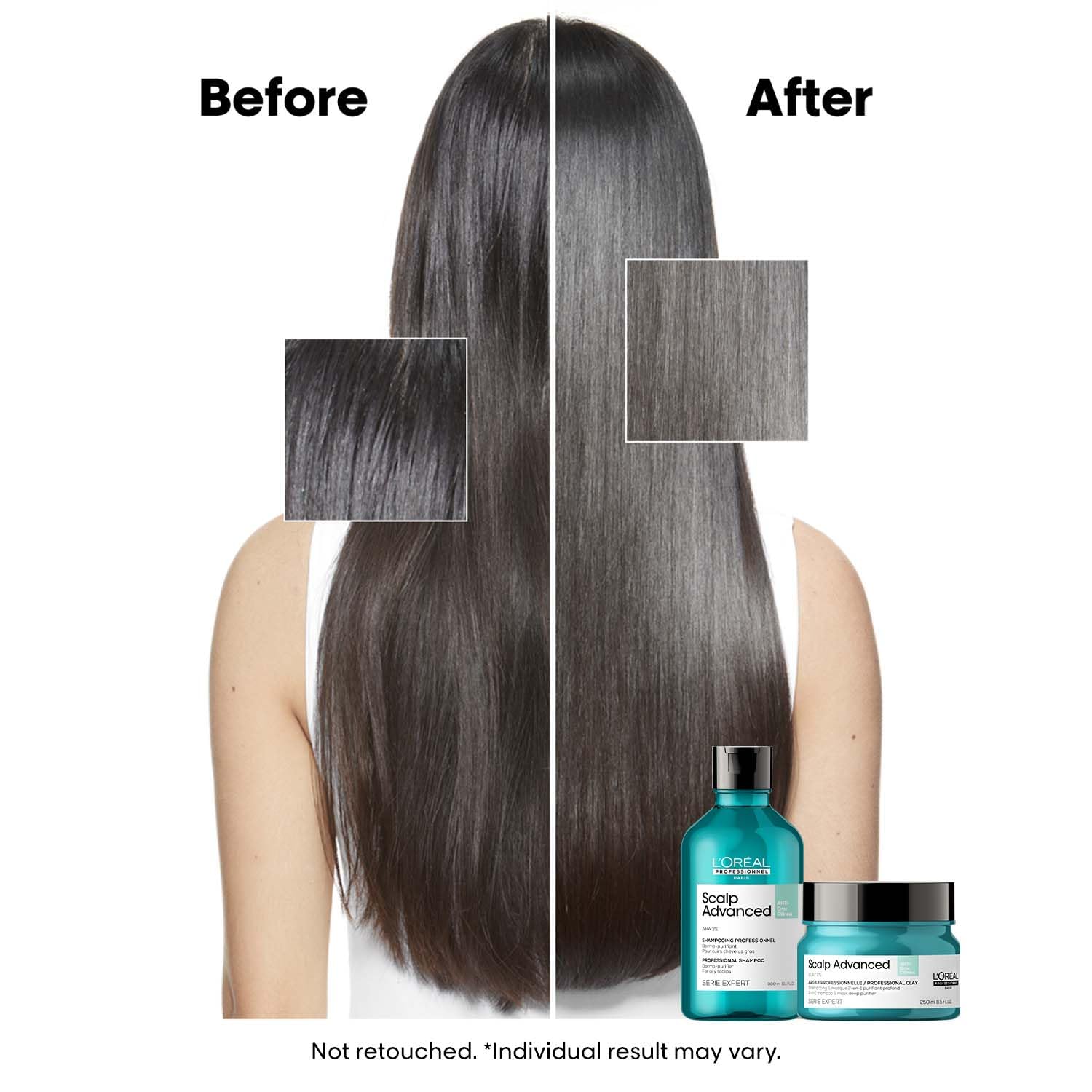 L’Oréal Professionnel Scalp Advanced Anti-Oiliness 2-in-1 Deep Purifier Clay Mask & Shampoo | Reduces Scalp Sebum & Gives Instant Volume | Powered by 6% Clay | For Men & Women, 250ml 1