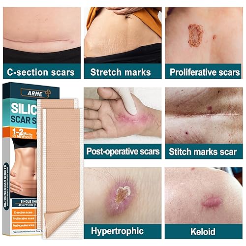 Miniatura 6 de Cinta de silicona para cicatrices Arme, paquete de 18 hojas de silicona para cicatrices, hojas de eliminación de cicatrices de grado médico