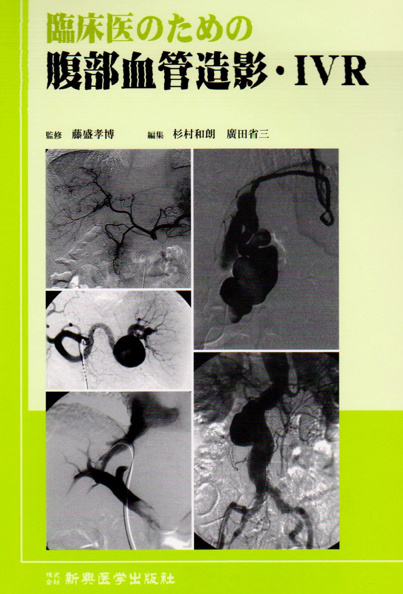 腹部血管造影ハンドブック 腹部血管造影ハンドブック 小児の超音波ガイド下血管穿刺と区域