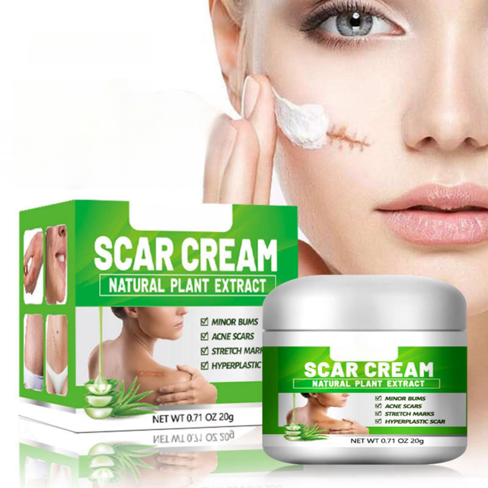 JDLYEVER Scar Repair Cream - Effective Scar Reduction - Natural Aloe Vera Formula - Versatile Scar Treatment - Deep Hydration - Soothing & Calming - for Face and Body - Enhances Skin Elasticity - 20g
