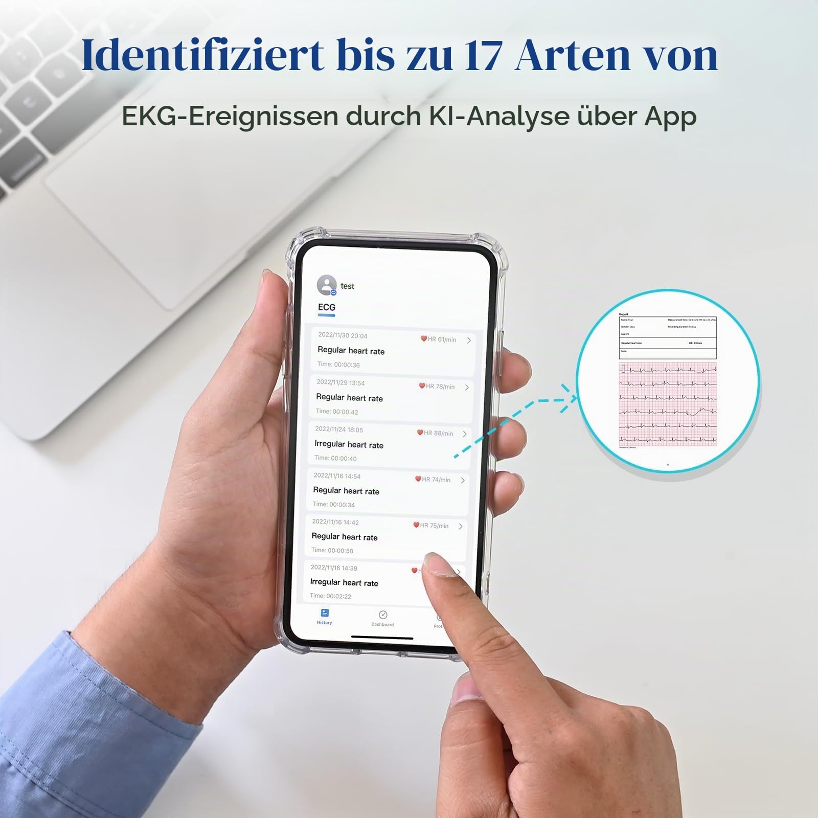 CheckMe ER2-S EKG Gerät für Zuhause & Unterwegs, EKG mit Brustgurt, 30s bis 15Min Messung, Echtzeit-APP, Unbegrenzter Speicher, 0.96" OLED, für iOS Android