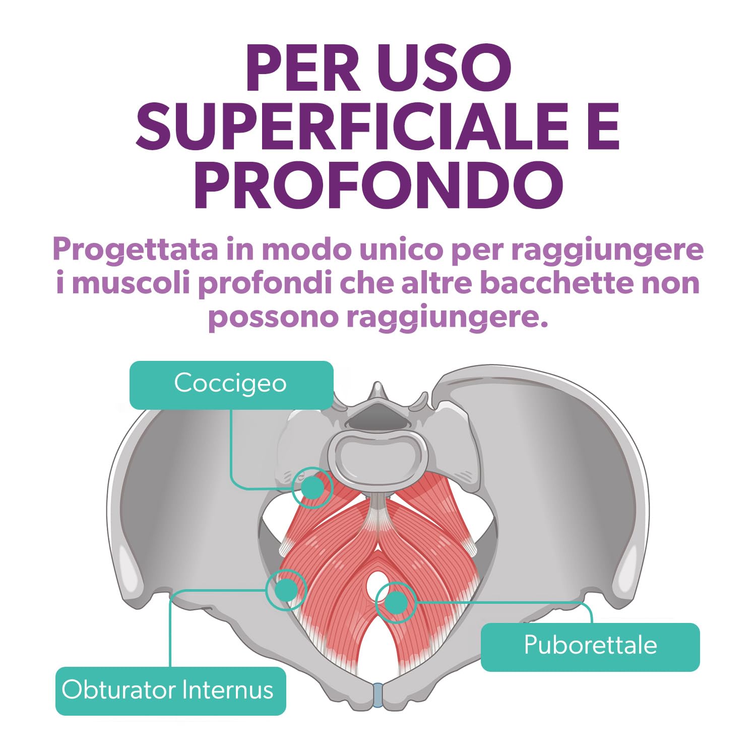 Intimate Rose - Bacchetta pelvica Cono per la ginnastica pelvica con vibrazione per alleviare i dolori muscolari pelvici per trigger point e punti tendenti per muscoli del pavimento pelvico