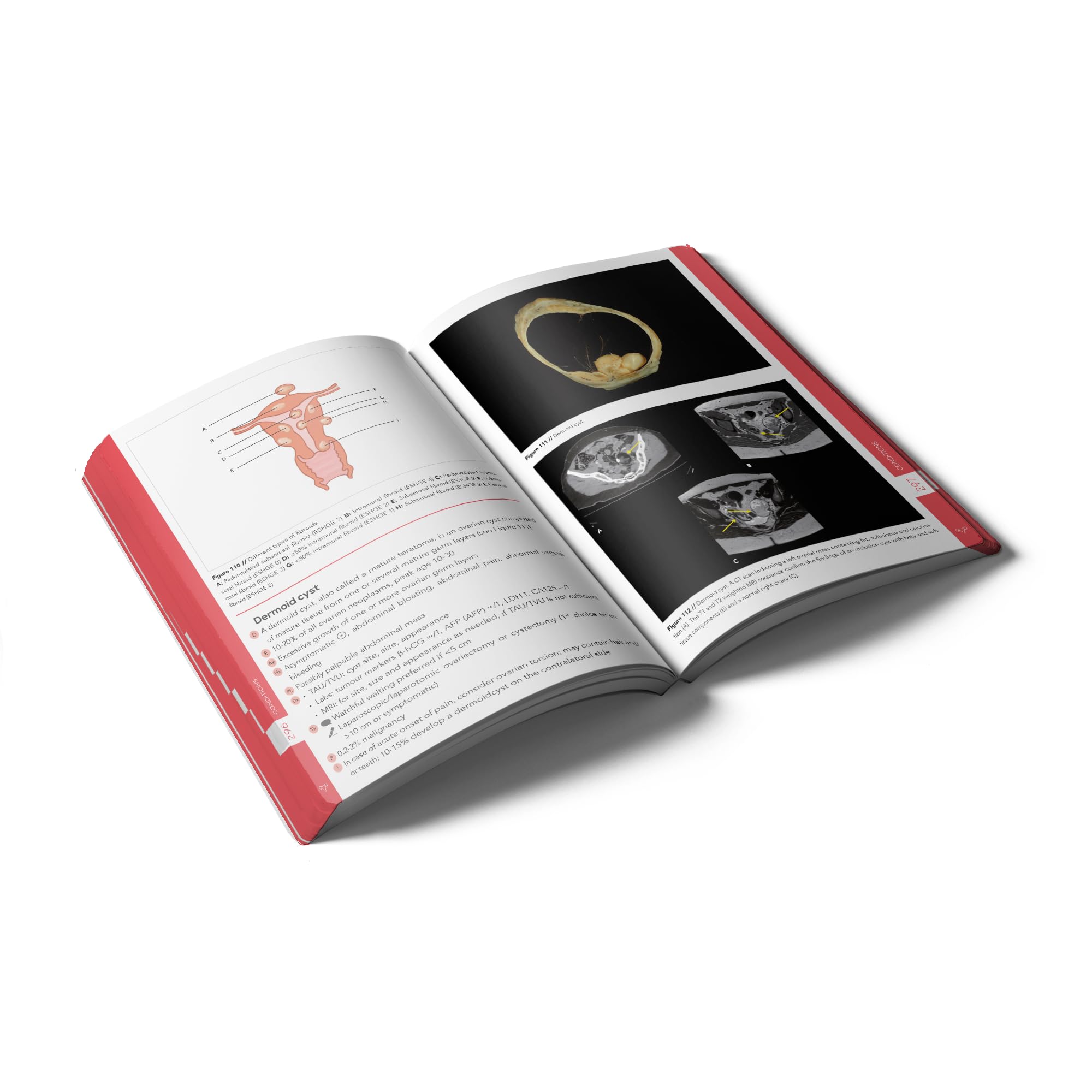 Pocket Obstetrics and Gynaecology: An essential pocket-sized book on Obstetrics and Gynaecology.