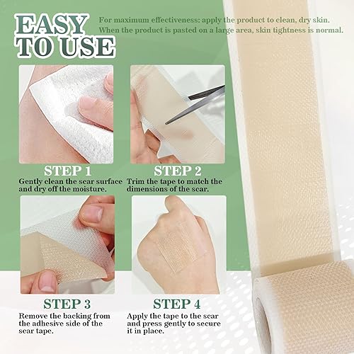 Miniatura 7 de Softxpp - Hojas de silicona de grado médico para cicatrices, cinta reutilizable para cicatrices de 1.6 x 60 pulgadas, rollo de 4.9 ft, tiras de