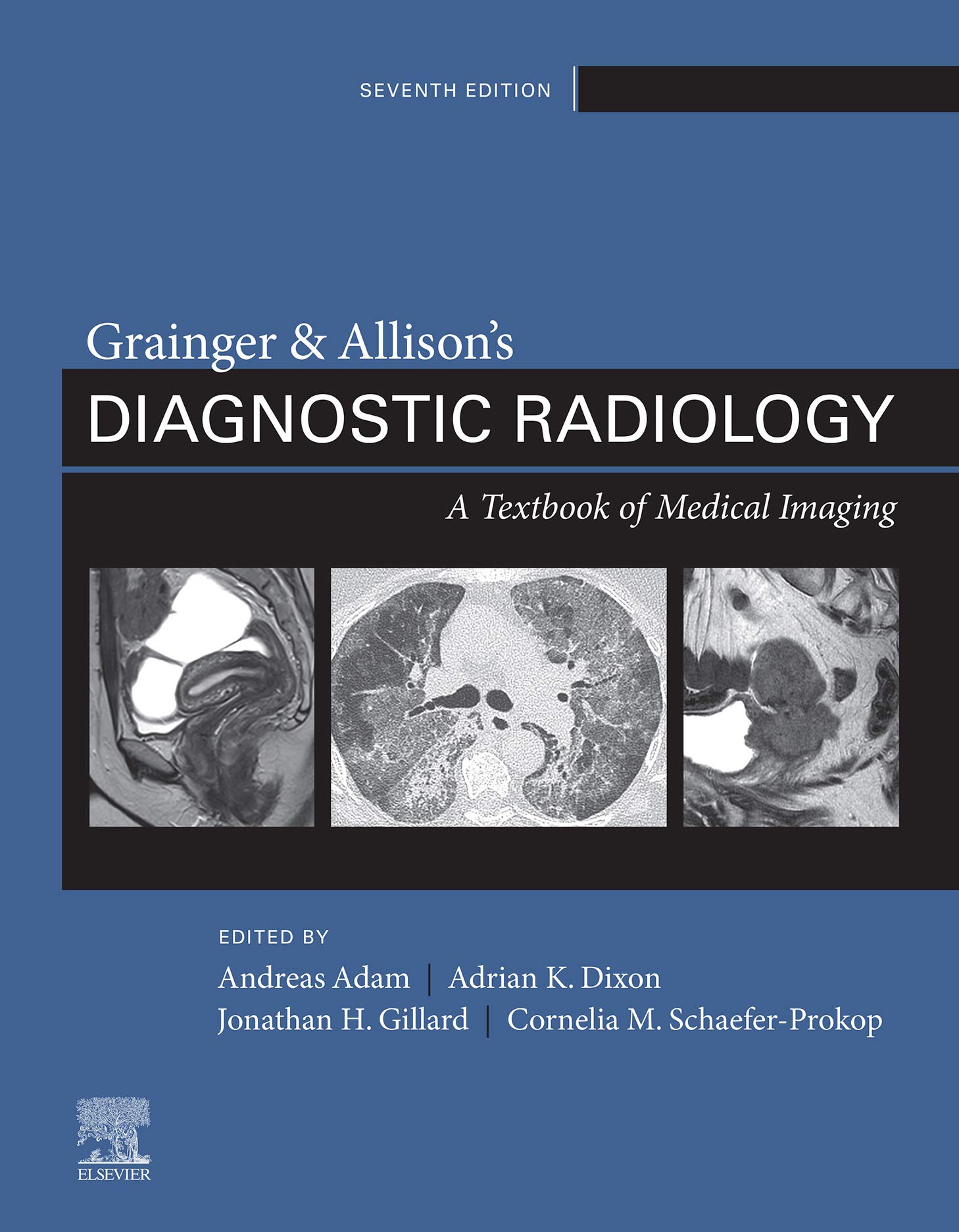 Grainger & Allison's Diagnostic Radiology: 2-Volume Set