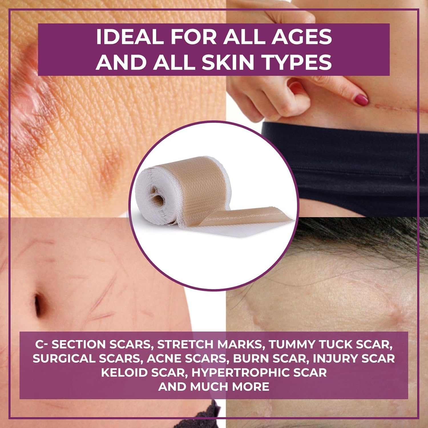 Amazon.com: HEALQU Medical Grade Silicone Scar Sheets - Non